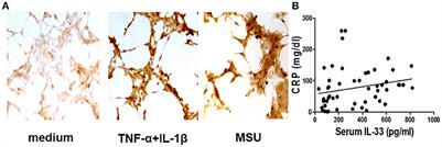 IL-33 Ameliorates the Development of MSU-Induced Inflammation Through Expanding MDSCs-Like Cells